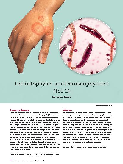 Vorschauseite 1: Dermatophyten und Dermatophytosen (Teil 2)