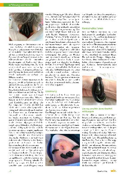 Vorschauseite 3: Blutegeltherapie: Eine Zusammenarbeit mit dem „ältesten Heiler der Welt“.