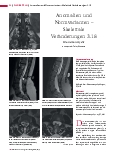 Vorschauseite 2: Anomalien und Normvarianten – Skelettale Veränderungen 3.18 Diastematomyelie