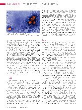 Vorschauseite 3: Geschichte der Erforschung von Leberkrankheiten (Teil 1)