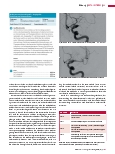 Vorschauseite 2: Interventionelle Therapie des Schlaganfalls