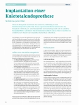 Vorschauseite 1: Implantation einer Knie-Totalendoprothese