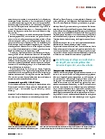 Vorschauseite 2: Diagnostik und Therapie der Karzinome des Magens