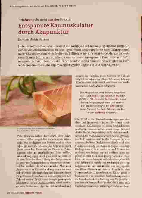 Vorschauseite 1: Entspannte Kaumuskulatur durch Akupunktur