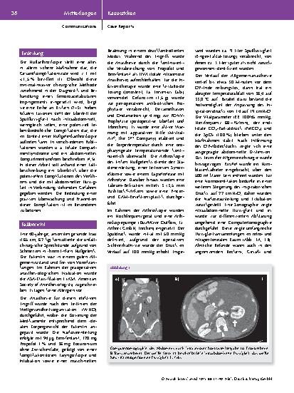 Vorschauseite 2: Intraabdominelle Flüssigkeit nach Hüftgelenkarthroskopie – Eine Fallvorstellung