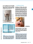 Vorschauseite 3: Narben als Störfeld