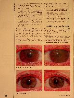 Vorschauseite 4: Post-COVID-Syndrom | Die Irisdiagnose als Ansatz für die Therapie