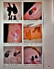 Vorschauseite 4: Durchblutungsstörungen - Eine Domäne der Blutegeltherapie