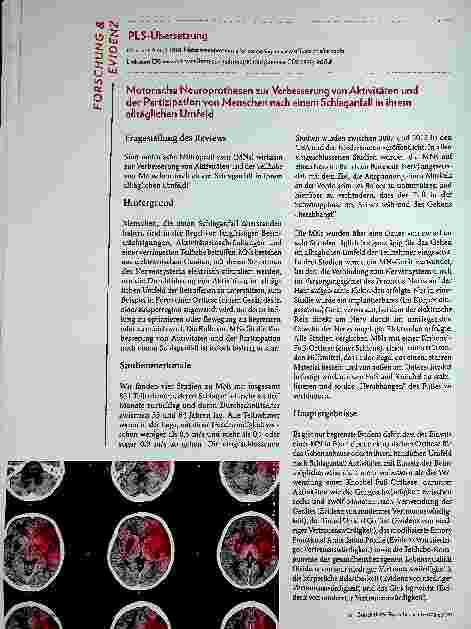 Vorschauseite 1: Motorische Neuroprothesen zur Verbesserung von Aktivitäten und der Partizipation von Menschen nach einem Schlaganfall in ihrem alltäglichen Umfeld.