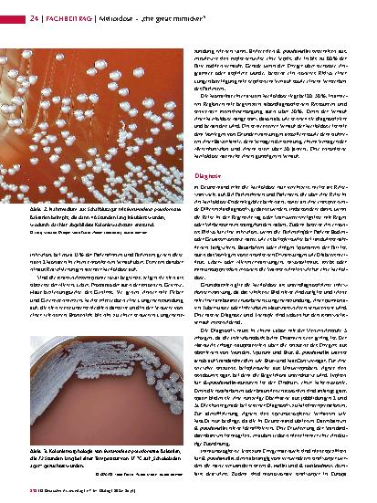 Vorschauseite 3: Melioidose – „the great mimicker“