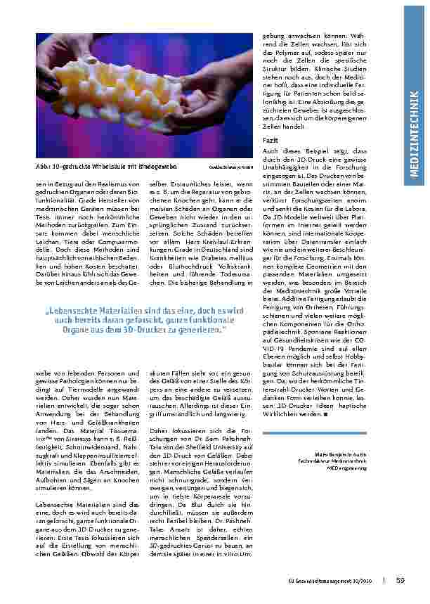 Vorschauseite 2: Vorstellungen Wirklichkeit verleihen: Anwendungsbereiche des 3D-Drucks im Krankenhaus und der Medizintechnik