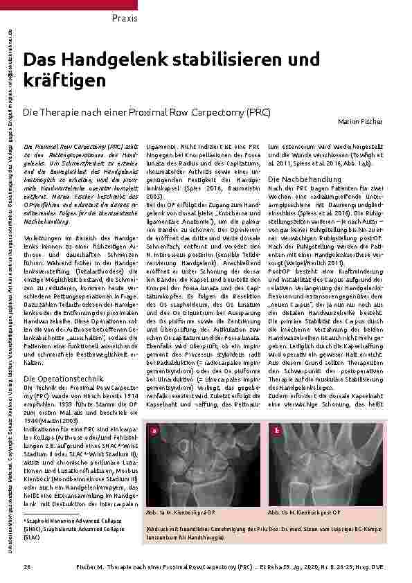 Vorschauseite 1: Das Handgelenk stabilisieren und kräftigen. Die Therapie nach einer Proximal Row Carpectomy (PRC).