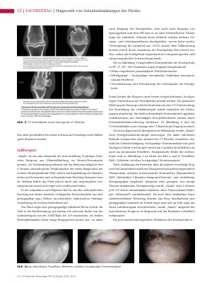 Vorschauseite 3: Diagnostik von Gelenkerkrankungen des Pferdes am Beispiel einer hochgradigen Osteoarthrose des Fesselgelenks