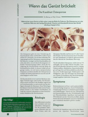 Vorschauseite 1: Wenn das Gerüst bröckelt Die Krankheit Osteoporose