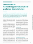 Vorschauseite 1: Transkatheter Aortenklappenimplantation - perkutan über die Leiste