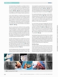 Vorschauseite 6: Transkatheter Aortenklappenimplantation - perkutan über die Leiste