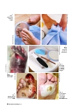Vorschauseite 1: Diabetisches Fußulkus: Risikofaktoren und Prävention