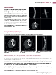 Vorschauseite 4: CT-Protokolle CT-Angiografie – Armarterien