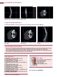 Vorschauseite 5: CT-Protokolle CT-Angiografie – Armarterien