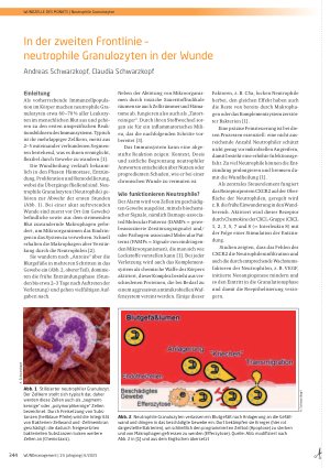 Vorschauseite 1: In der zweiten Frontlinie – neutrophile Granulozyten in der Wunde