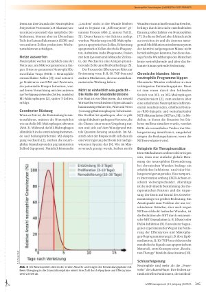 Vorschauseite 2: In der zweiten Frontlinie – neutrophile Granulozyten in der Wunde