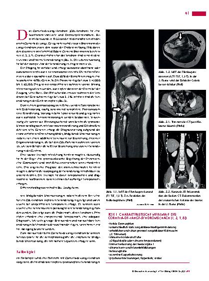 Vorschauseite 2: Anomalien und Normvarianten – Komplexe Veränderungen: Cornelia-de-Lange-Syndrom