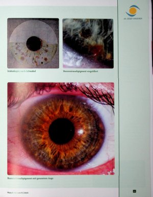 Vorschauseite 2: Das Beerenstrauchpigment Lexikon der Augendiagnose