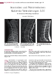 Vorschauseite 1: Anomalien und Normvarianten: Skelettale Veränderungen 3.25 Persistierende Wirbelkörperrandleisten