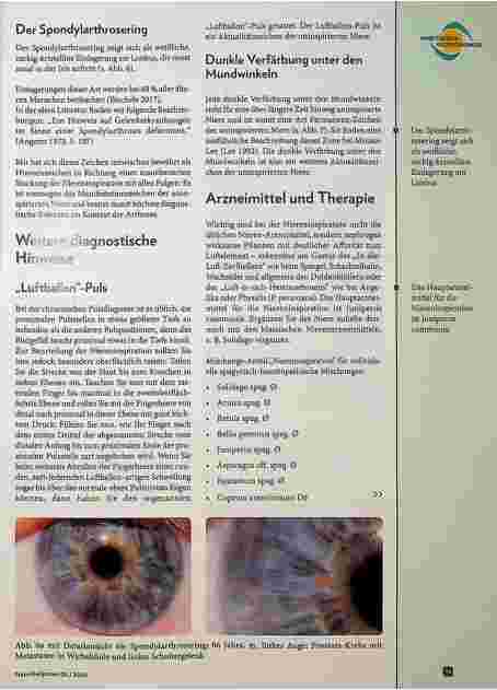 Vorschauseite 4: Arthrose, die unispirierte Niere und die Augendiagnose