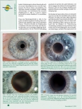 Vorschauseite 3: Informationsquelle Auge sehen, was uns der Patient vielleicht nicht sagt.