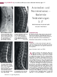 Vorschauseite 1: Anomalien und Normvarianten – Skelettale Veränderungen 3.17 Persistierende Chorda dorsalis