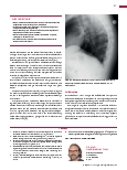 Vorschauseite 2: Anomalien und Normvarianten – Skelettale Veränderungen 3.17 Persistierende Chorda dorsalis