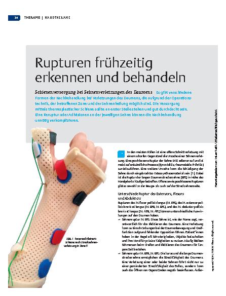Vorschauseite 1: Rupturen frühzeitig erkennen und behandeln