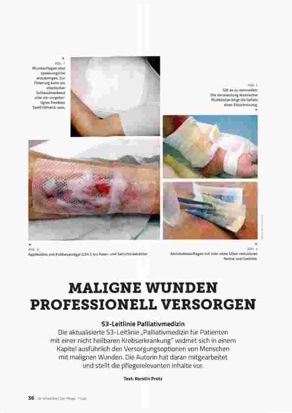 Vorschauseite 1: MALIGNEN WUNDEN PROFESSIONELL VERSORGEN