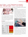 Vorschauseite 2: Einfluss der aktiven Kopfrotation auf Kauund Nackenmuskeln während der Flaschenfütterung bei Säuglingen mit und ohne Torticollis