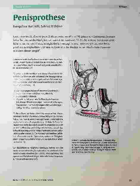 Vorschauseite 1: Penisprothese
