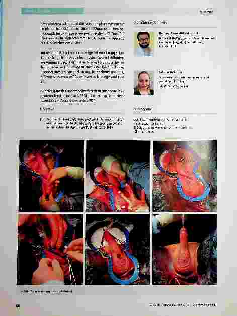Vorschauseite 6: Penisprothese