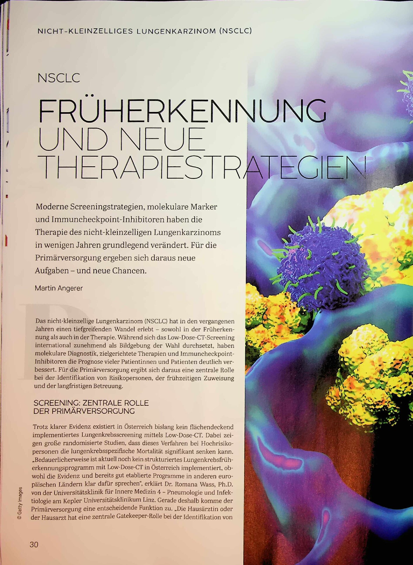 Vorschauseite 1: Nicht-kleinzelliges Lungenkarzinom (NSCLC): Früherkennung und neue Therapiestrategien