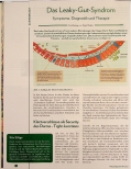 Vorschauseite 1: Das Leaky-Gut-Syndrom: Symptome, Diagnostik und Therapie