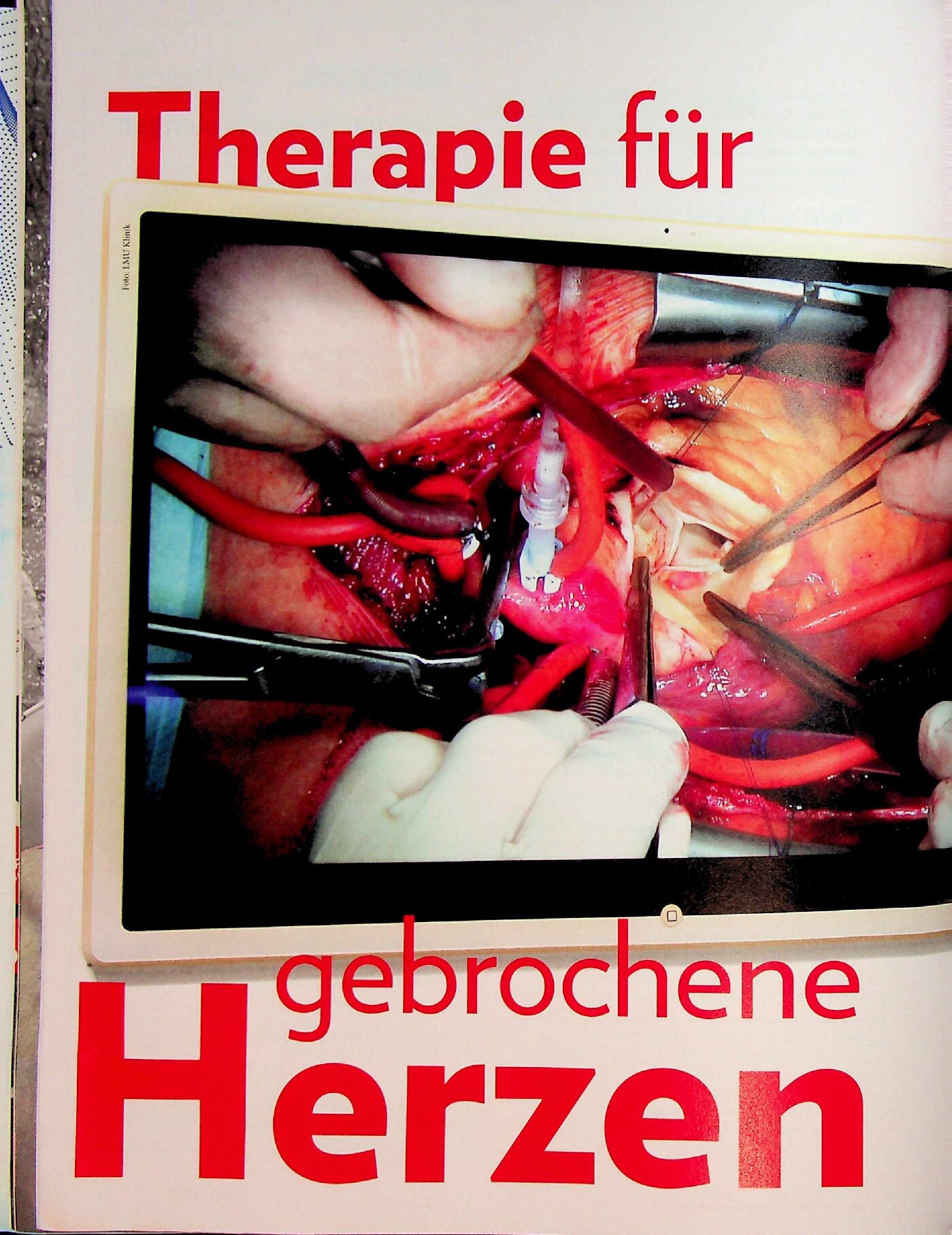 Vorschauseite 1: Prähabilitation vor dem ersten Schnitt