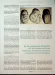Vorschauseite 4: Wie palpitiert die Hebamme die Fruchtwassermenge?