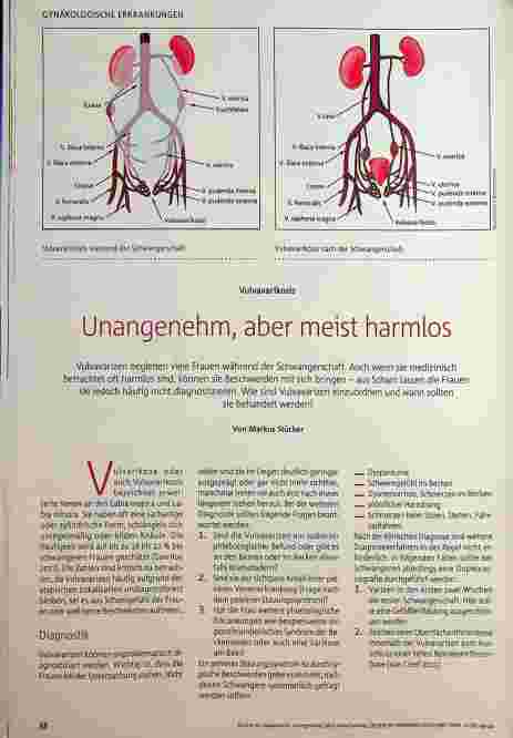 Vorschauseite 1: Vulvavarikosis Unangenehm, aber meist harmlos