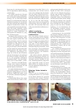 Vorschauseite 2: Die Vakuumversiegelungstherapie von Wunden (NPWT) im Einheitlichen Bewertungsmaßstab (EBM)