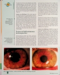Vorschauseite 3: Energiemangel im Fokus der Augendiagnose Teil 2