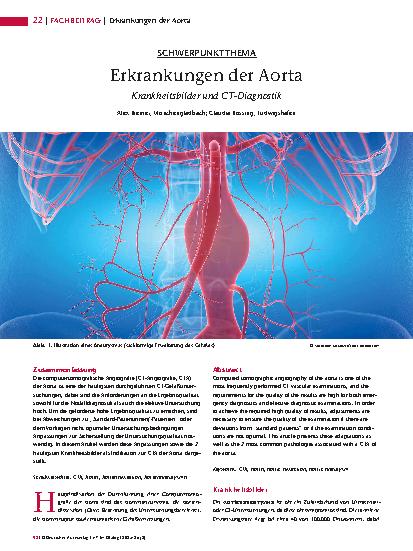 Vorschauseite 1: Erkrankungen der Aorta Krankheitsbilder und CT-Diagnostik