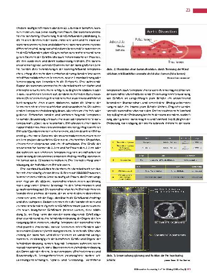 Vorschauseite 2: Erkrankungen der Aorta Krankheitsbilder und CT-Diagnostik