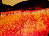 Vorschauseite 1: Spuren der Sepsis