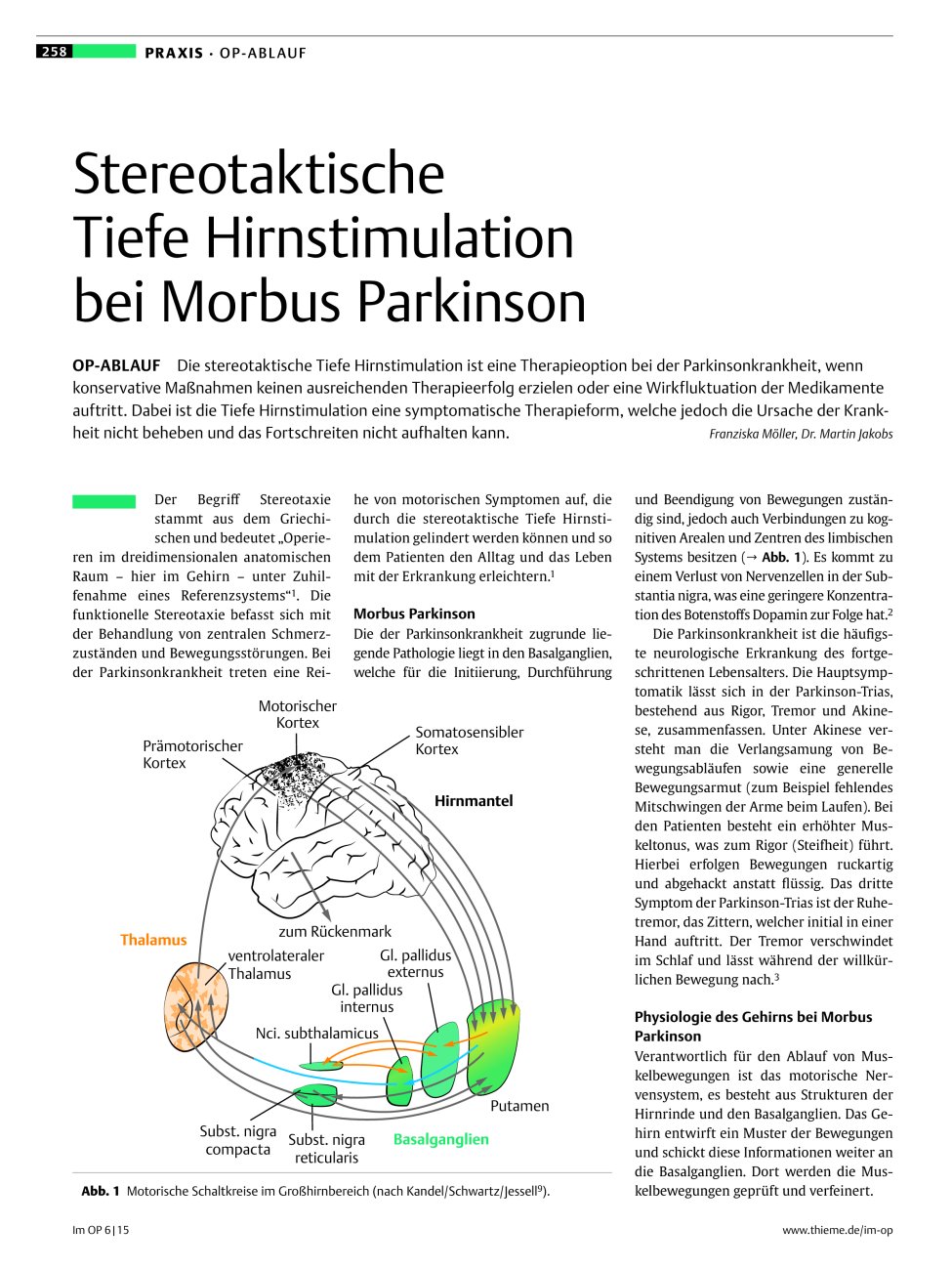 Vorschauseite 1: Stereotaktische Tiefe Hirnstimulation bei Morbus Parkinson