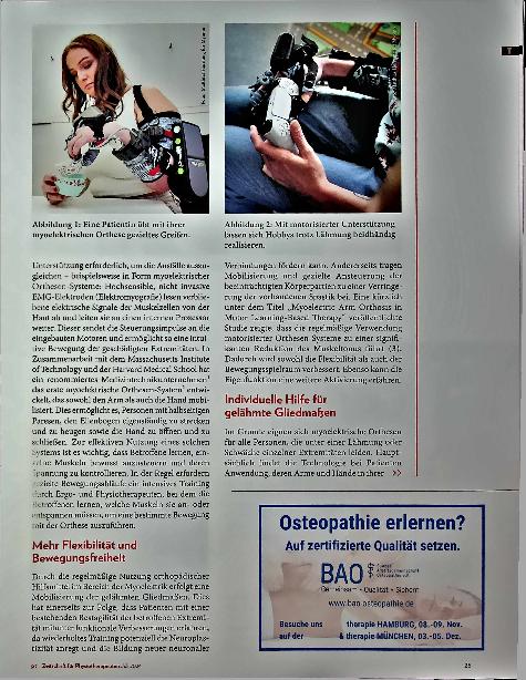 Vorschauseite 2: Wieder mehr Beweglichkeit. Myoelektrische Orthesen verbessern Funktionalität.
