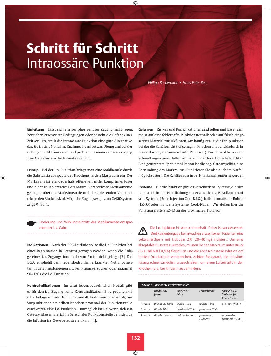 Vorschauseite 1: Schritt für Schritt ? Intraossäre Punktion
